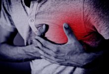 infarkt
