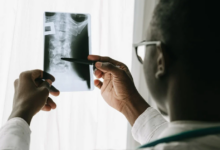 Jak byly objeveny rentgenové paprsky a kdy vznikl první rentgen?