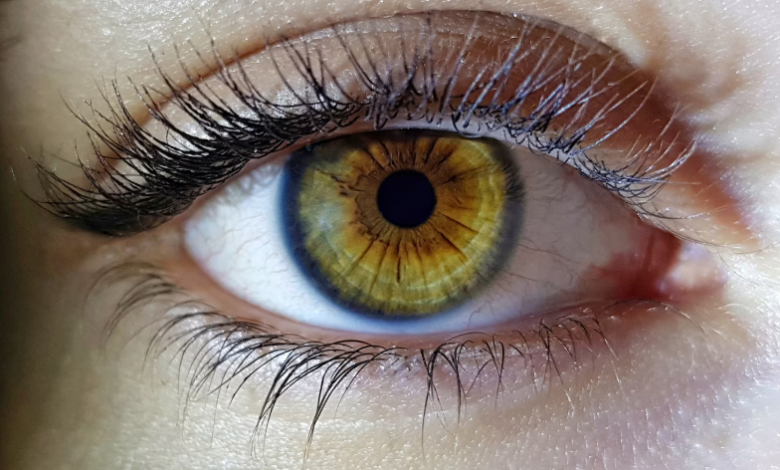 Co je centrální heterochromie a co ji způsobuje?